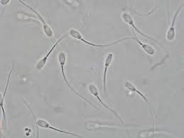 <p>is a motile male gamete characterized by a flagellum, enabling movement towards the ovum for fertilization. </p>