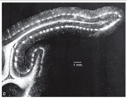 <p>how was this photomicrograph acquired?</p>