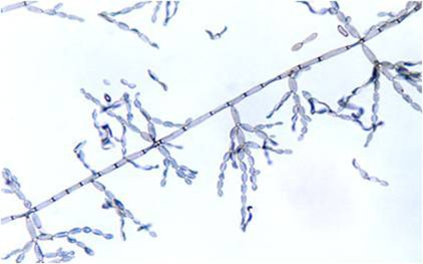 <p>Moderately slow; 7 days to mature</p><p>Powdery, velvet, dark gray, green; heaped and folded</p><p>Reverse: black</p><p>Microscopic: septate hyphae, short chains of dark blastoconidia</p><p>Conditions: keratomycosis/allergies</p>