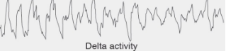 <p>High-amplitude and low-frequency<strong> delta activity</strong> <mark data-color="#d5fcf5" style="background-color: #d5fcf5; color: inherit">(less than 3.5 Hz)</mark></p><p>Slowing down of brain activity as well as other bodily functions, such as heart rate, breathing, temperature, kidney function, etc</p><p>Sometimes referred to as slow-wave sleep (SWS), or deep sleep </p>