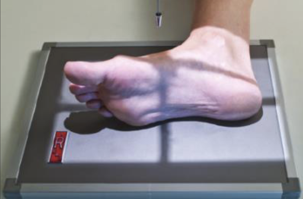 <p>Fine FS, 100cm</p><p>57kVp, 3mAs</p><p>Straight tube</p><p>CR: midfoot</p>