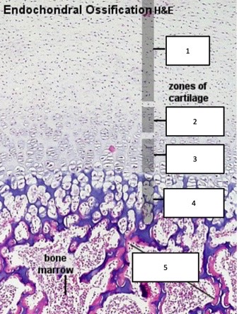 <p>name each zone in an epiphyseal growth plate</p>