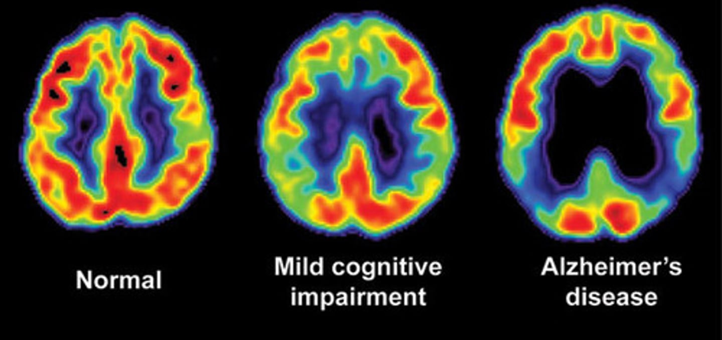 <p>using a computerized radiographic technique to examine the metabolic activity in various tissues (especially in the brain)</p>