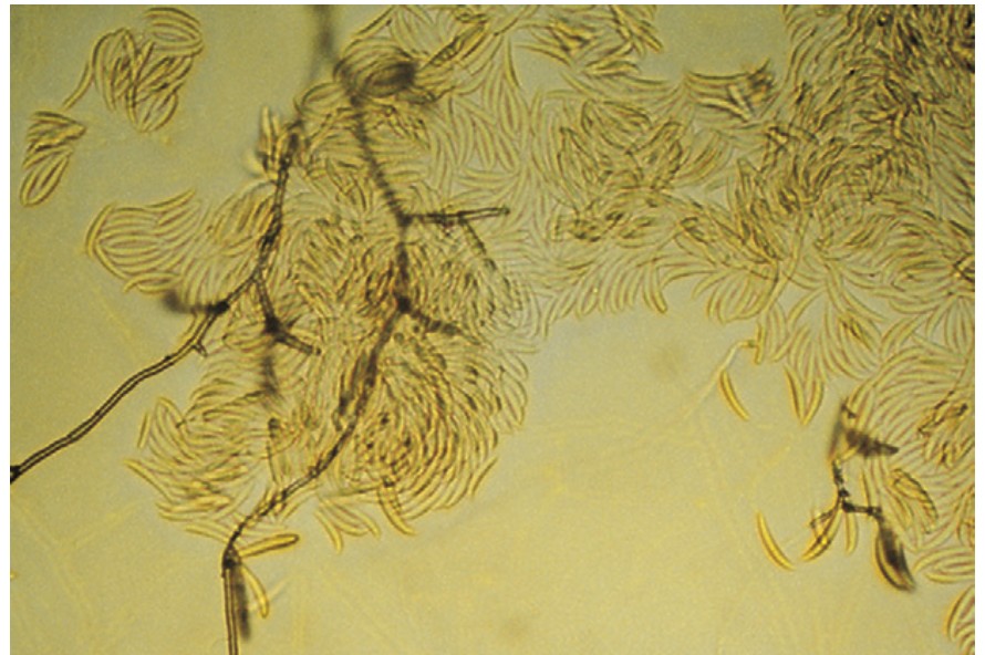 <p>A genus of filamentous fungi, some species of which are plant pathogens.</p>