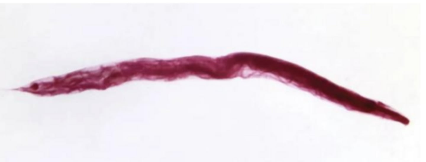 <p>Enterobius (pinworm) - nematode</p>