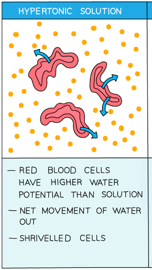 <ul><li><p>More concentrated solution (hypertonic)</p></li><li><p><strong>Lower water potential </strong>outside the cell</p></li><li><p>Water will move <strong>out</strong> of the cell by osmosis down the water potential gradient</p></li><li><p>The cell will <strong>crenate</strong> (shrivel)</p></li></ul>