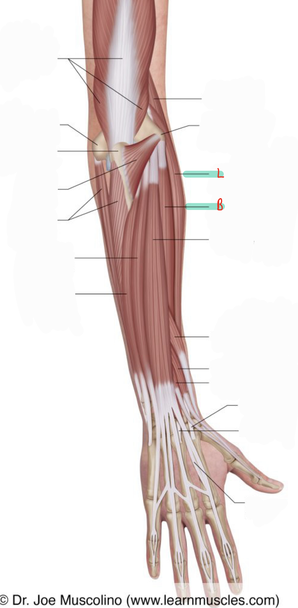 <p>Extends and ABducts wrist; acts with Flexor carpi radialis to ABduct wrist</p>
