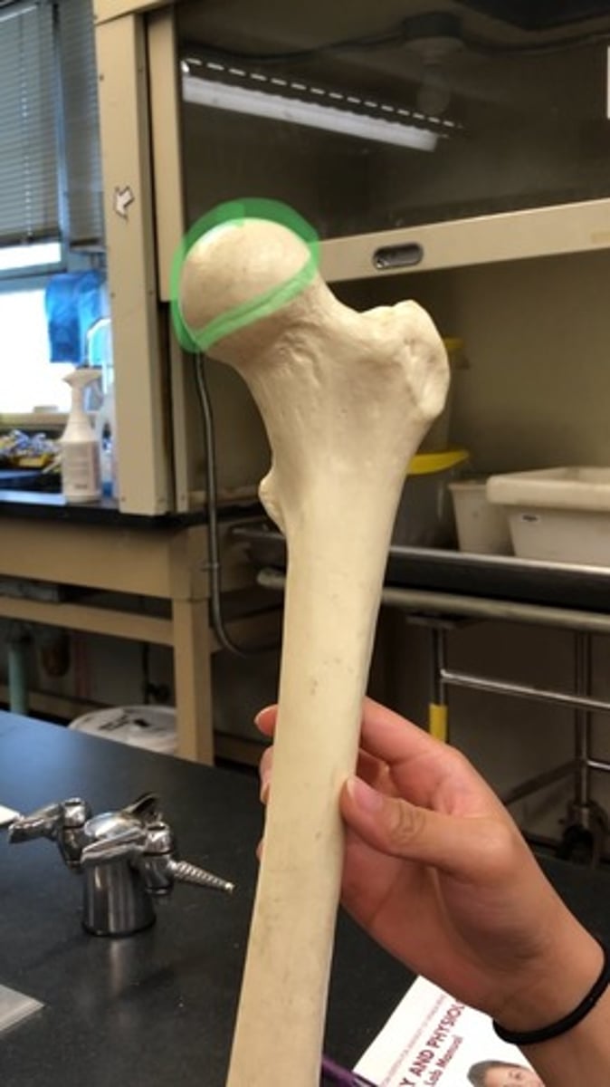 <p>medial</p>