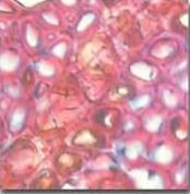 <p>What kind of Resolution error in photomicrography is this ? </p>