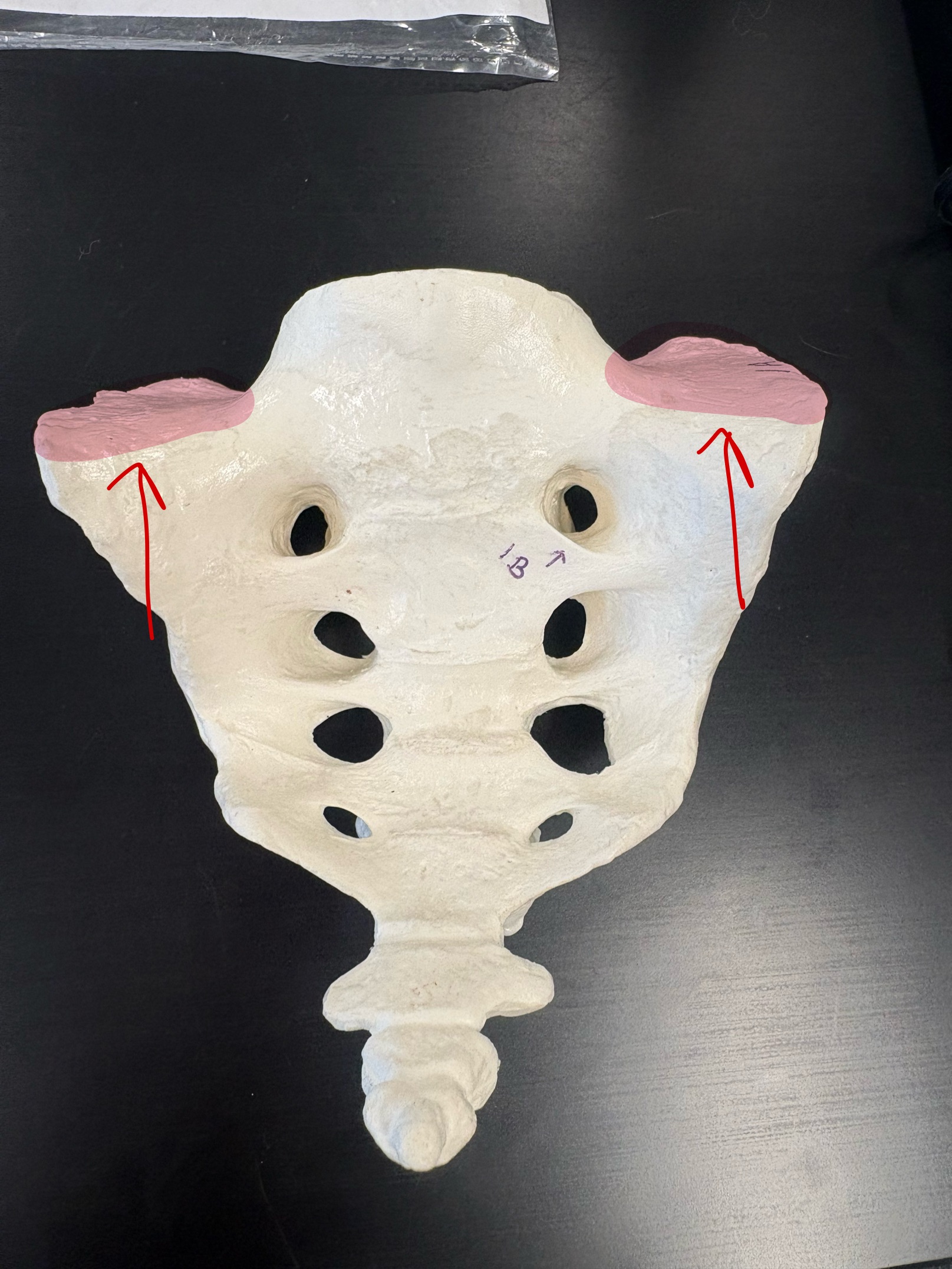 <p>Name this structure</p>