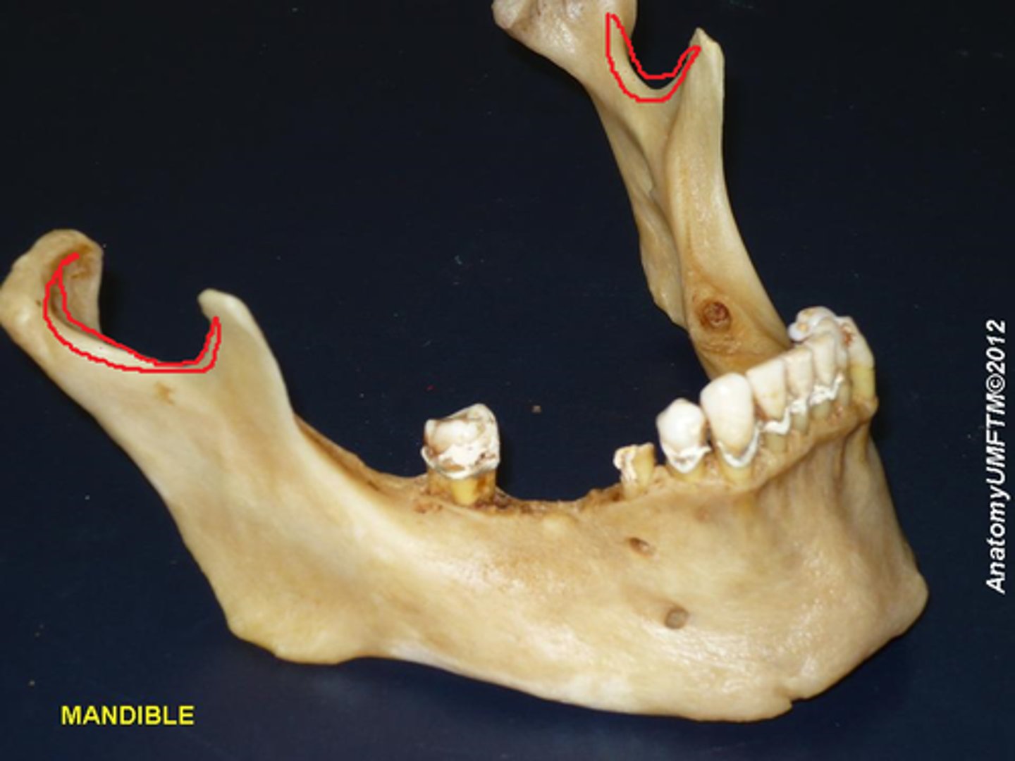 <p>Identify the structure</p>