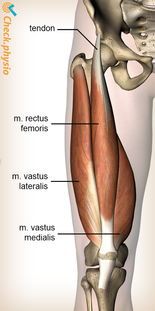 <p>Starts from illum, runs down the middle into the knee</p>