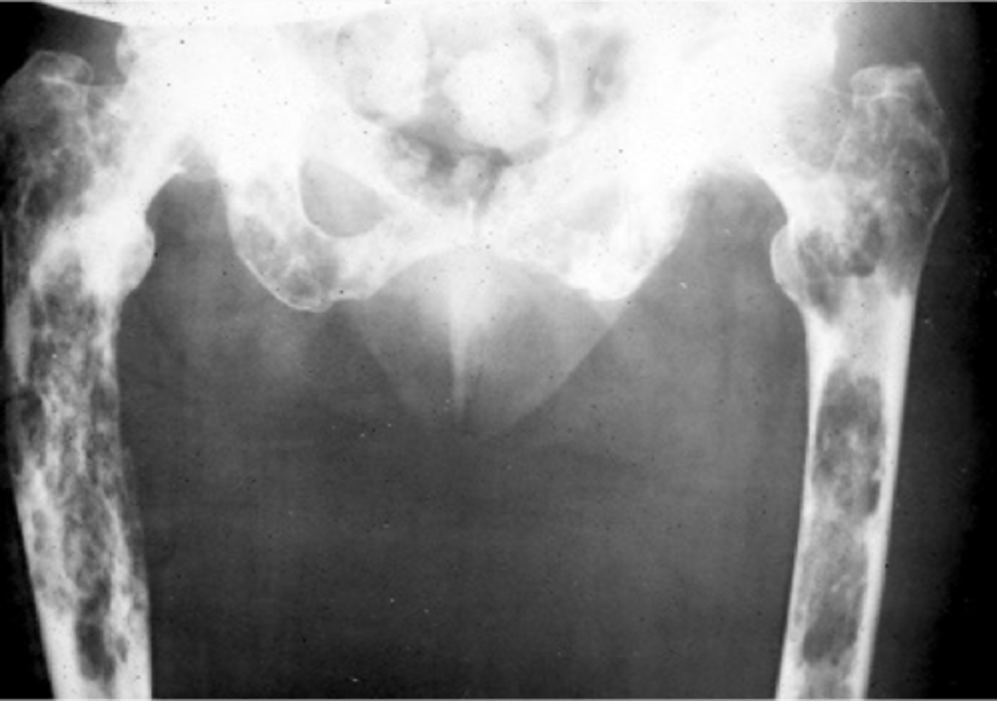 <p>ID radiologic pattern of disease</p>