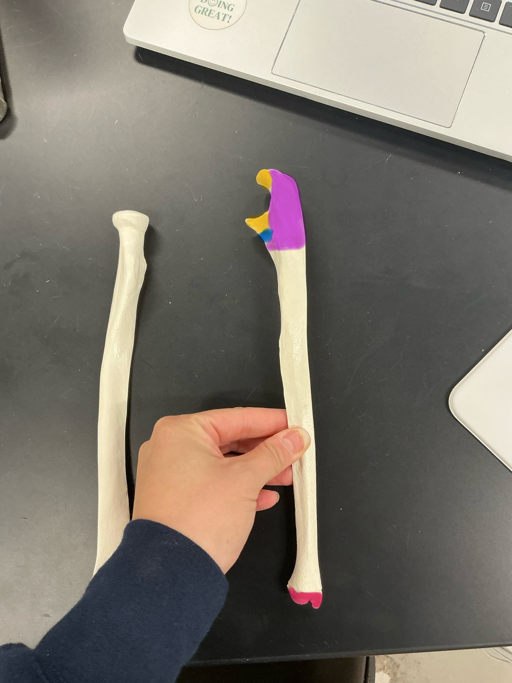 <p>Purple part</p>