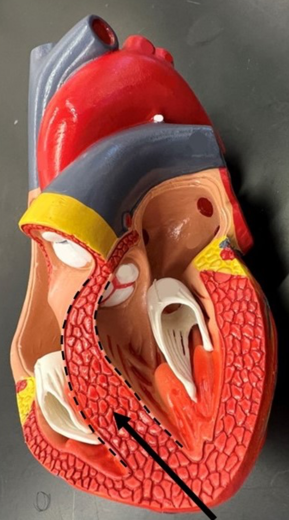 term image