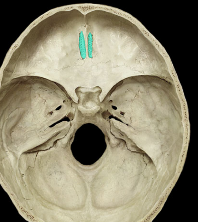 <p>what part of the ethmoid bone is highlighted </p>