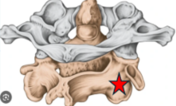 <p>What is the name on the starred vertebra on the picture below?</p>