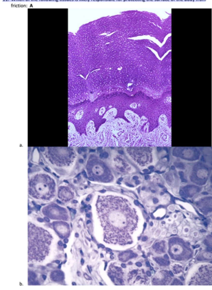 <p>Which of the following tissues is likely responsible for protecting the surface of the body from friction</p>