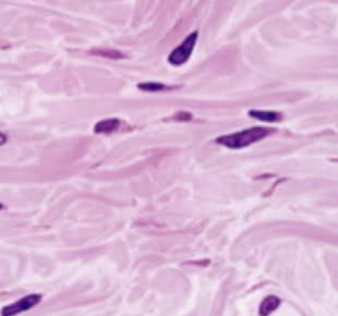 <p>What is this image?</p>