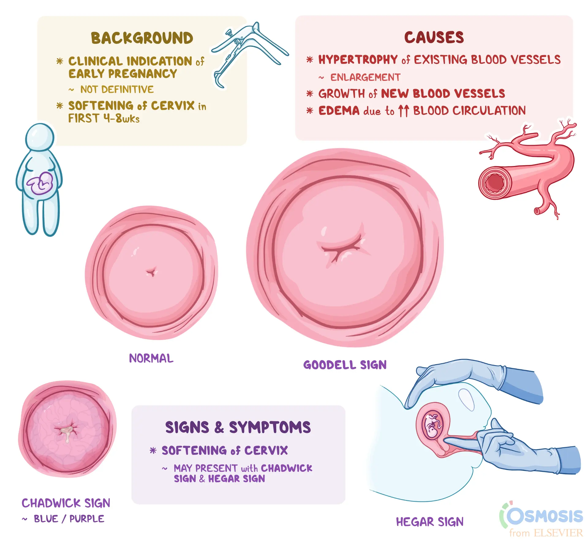 <p>softening of the cervix from firm (tip of nose) to soft (earlobe consistency)</p>