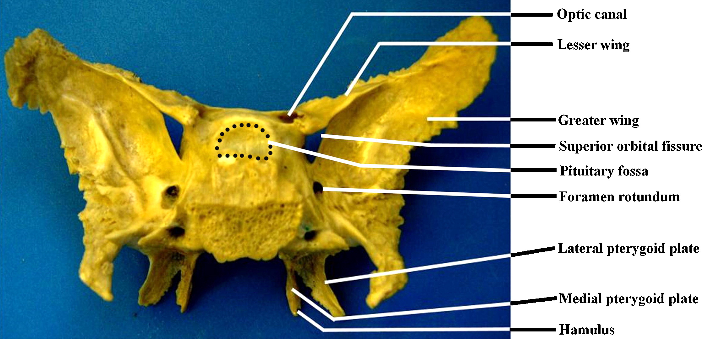 knowt flashcard image
