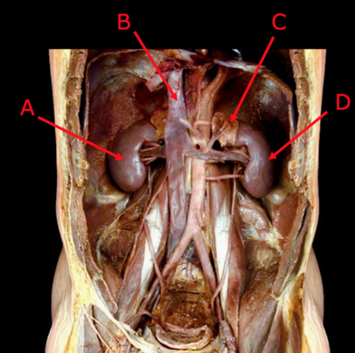 <p>Hormone-producing glands located superior to the kidneys.</p><p>Pyramid shaped.</p>