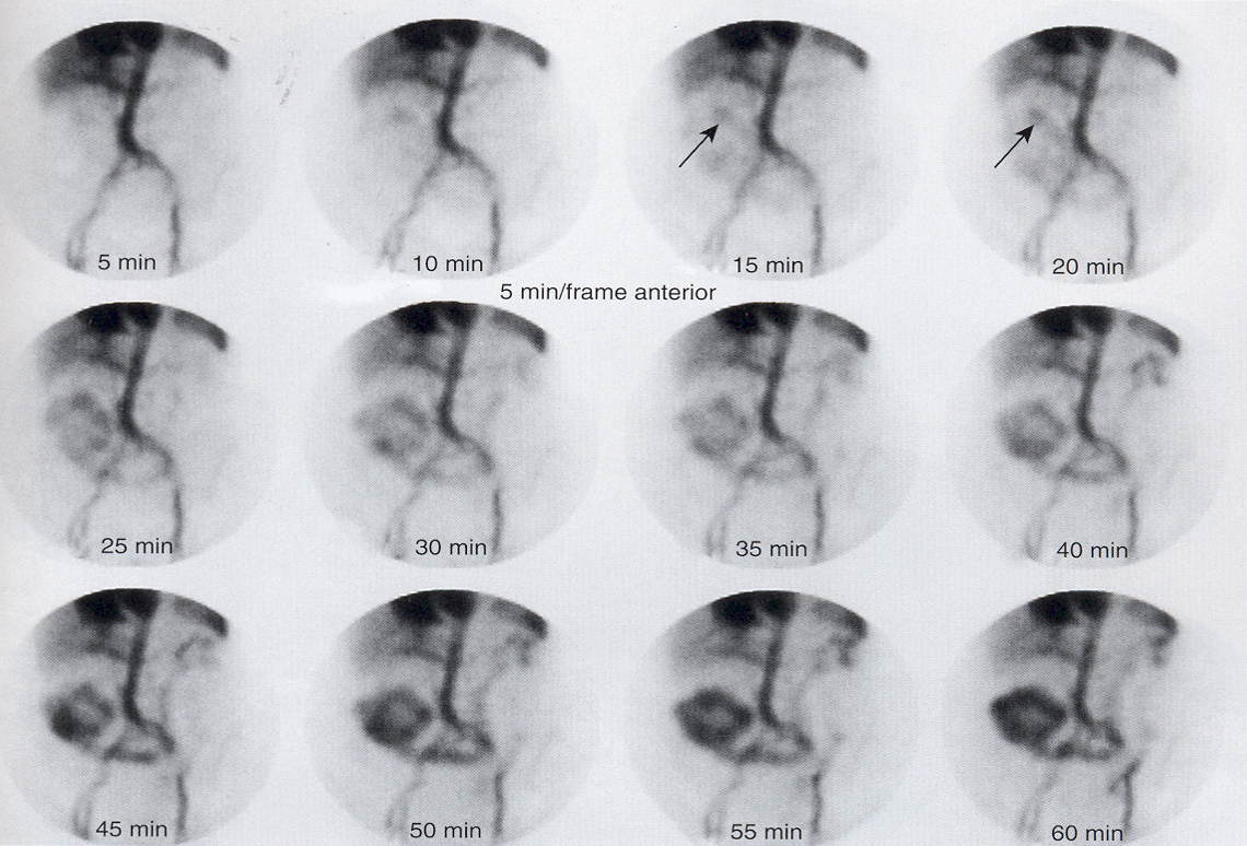 <p>is this using Tc-RBC’s or Tc-SC?</p>