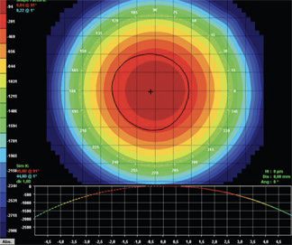 <p>K-map for spherical cornea</p>