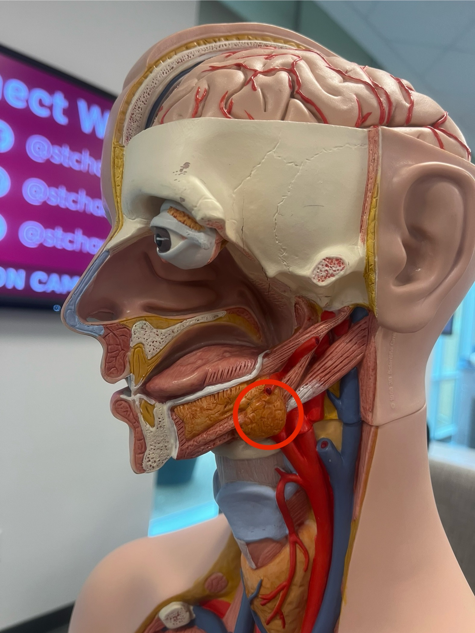 <p>what gland is this?</p>