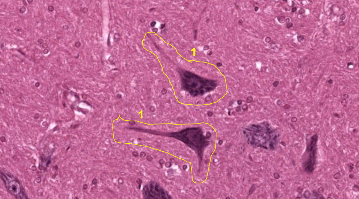 term image