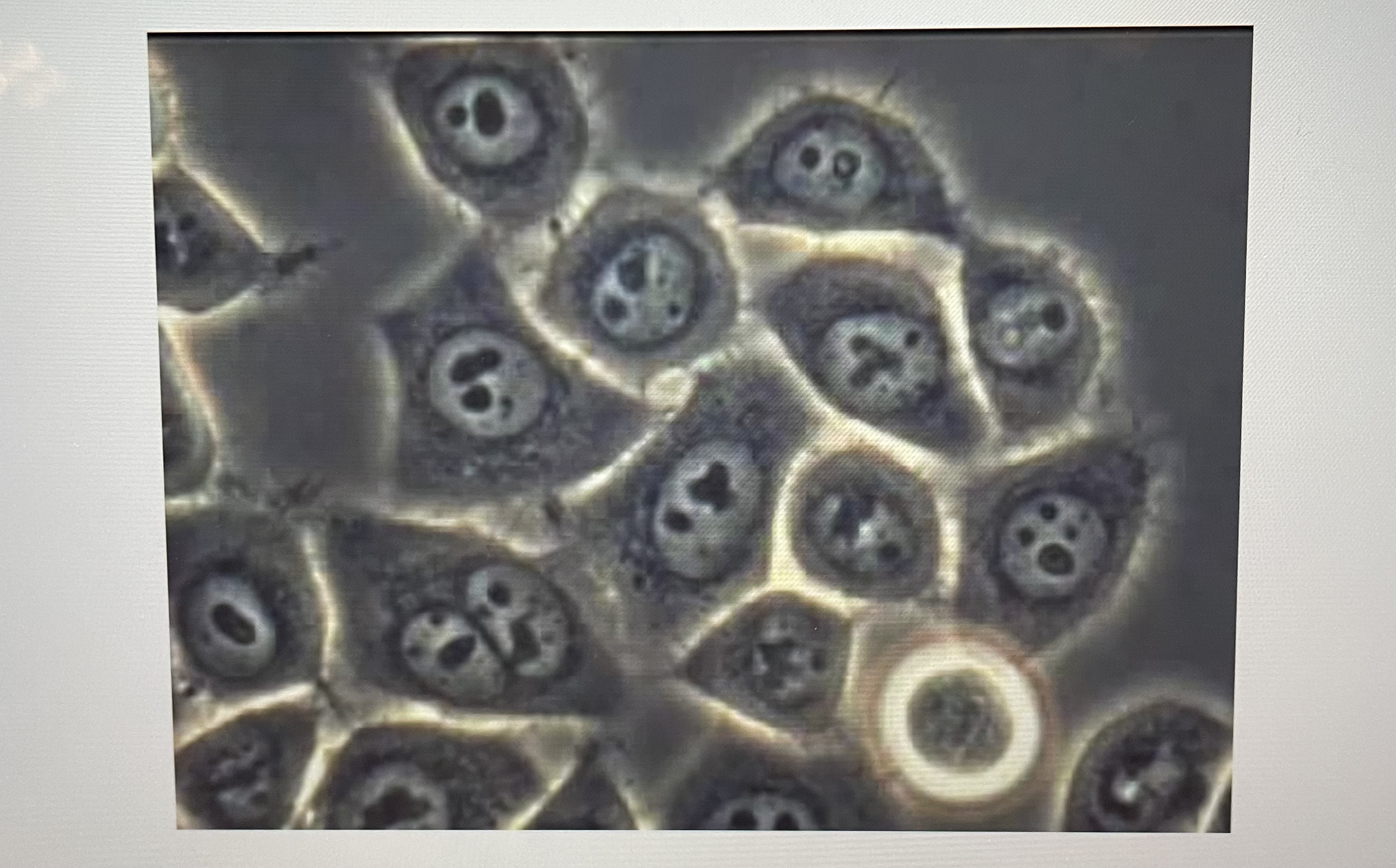 These cells are from a biopsy of a uterus, based on your knowledge of these cells they appear
