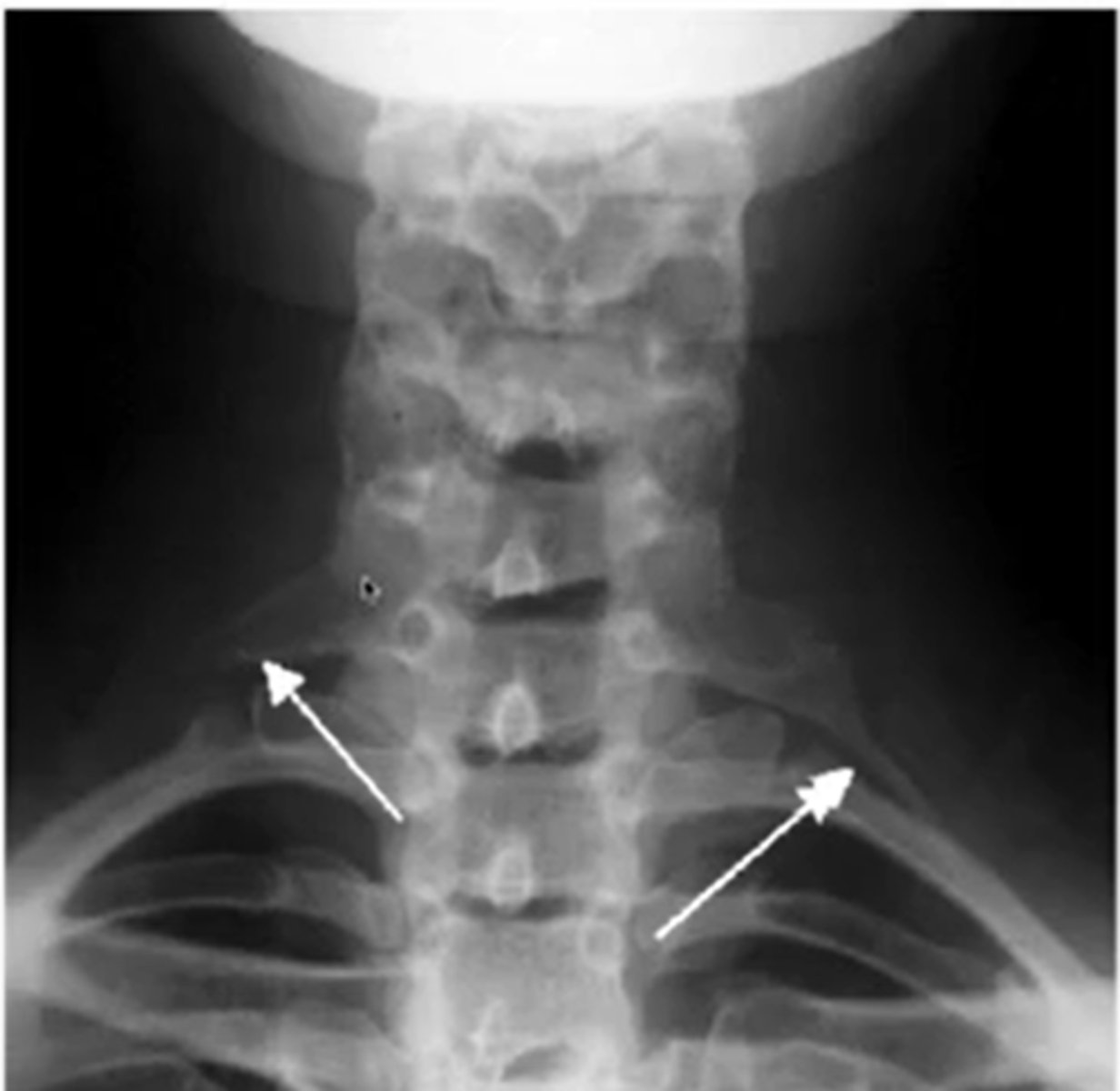 <p>correct number of bones</p><p>the size of bones</p><p>bone abnormalities</p><p>developmental deformities (growth plate not closed)</p><p>contour of bones</p><p>cortical bone outline</p><p>bone spurs</p>