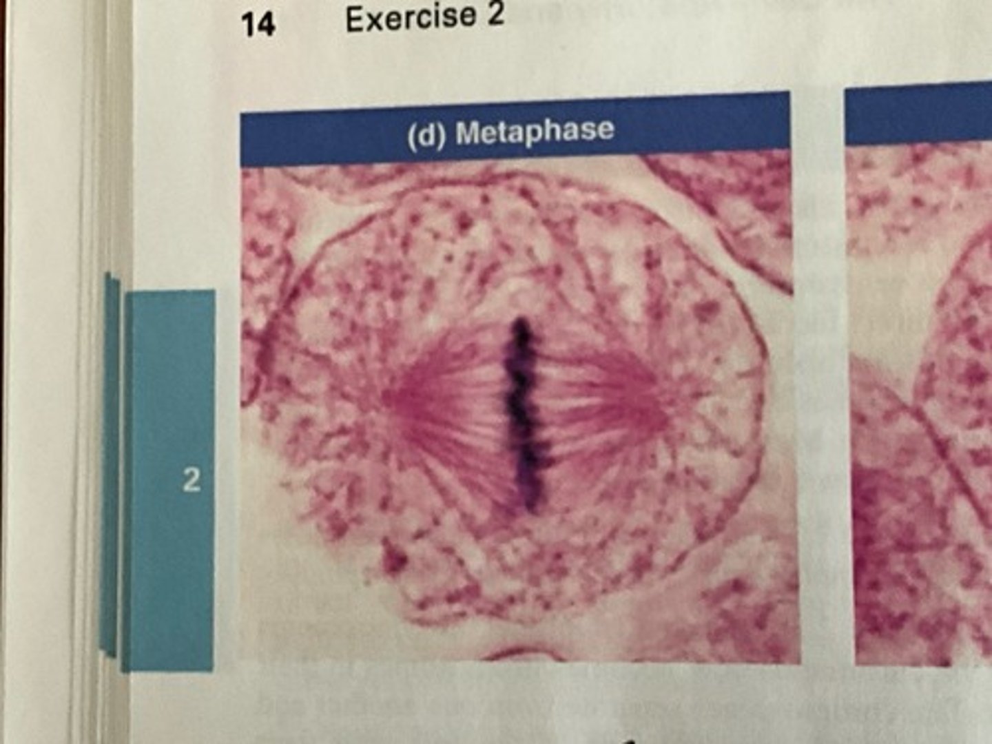 <p>Metaphase</p>