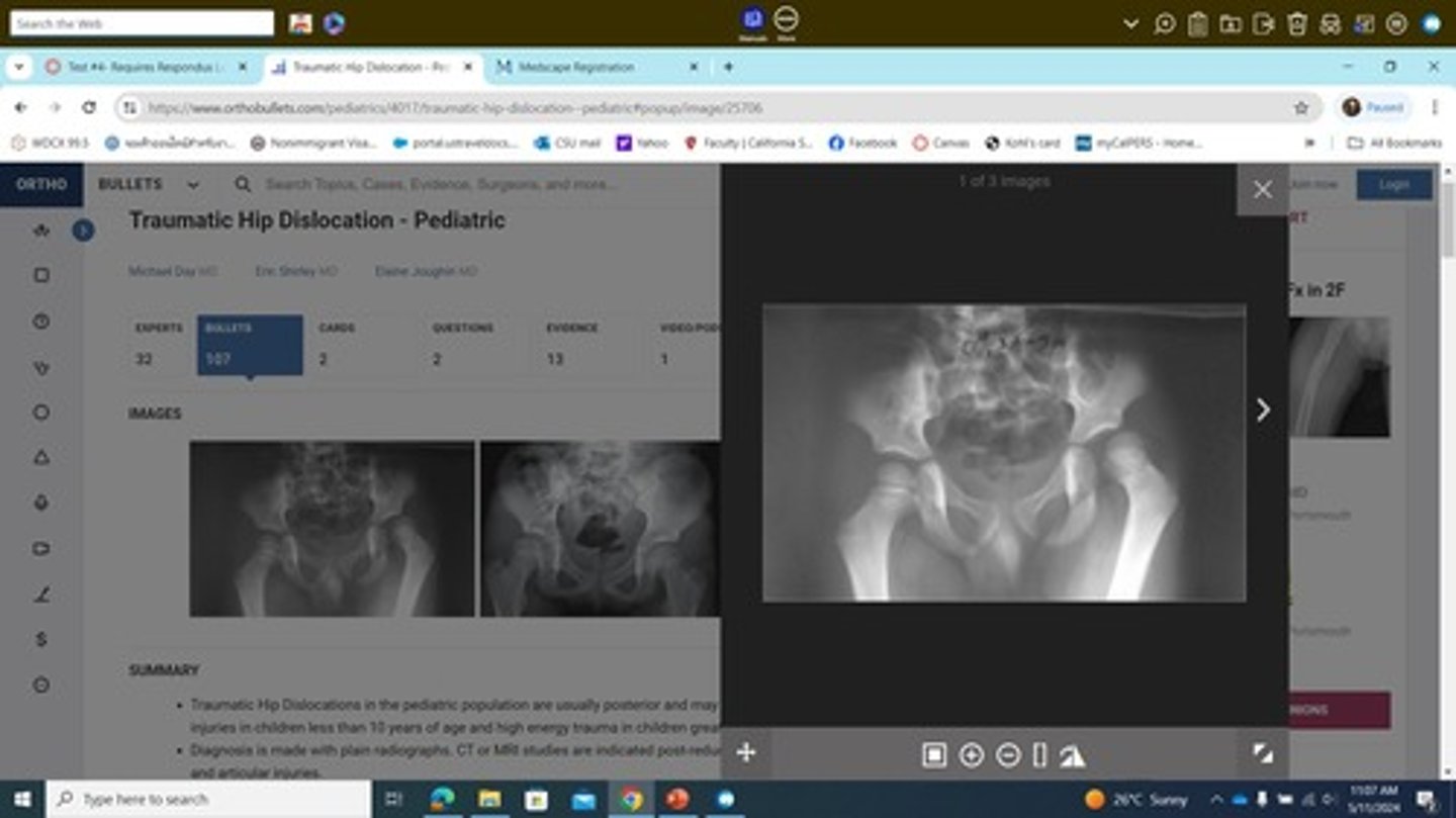 <p>Falling on an outstretched arm or excessive overhead activity</p>