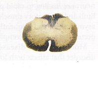 <p>Which spinal cord segment?</p>