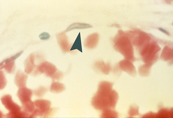 term image