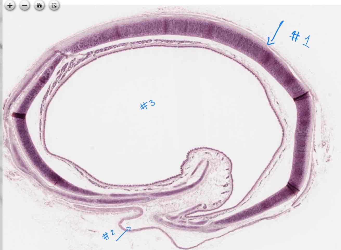 <p>What structure is #1 referencing?</p>