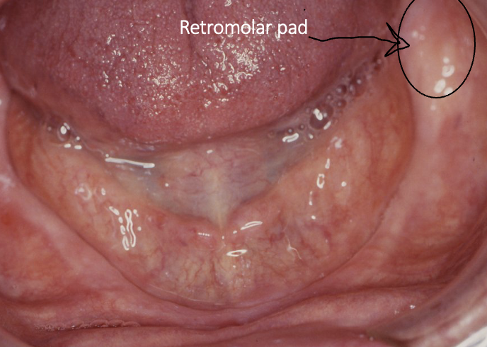 <ul><li><p>mandibular structures </p></li></ul><p></p>