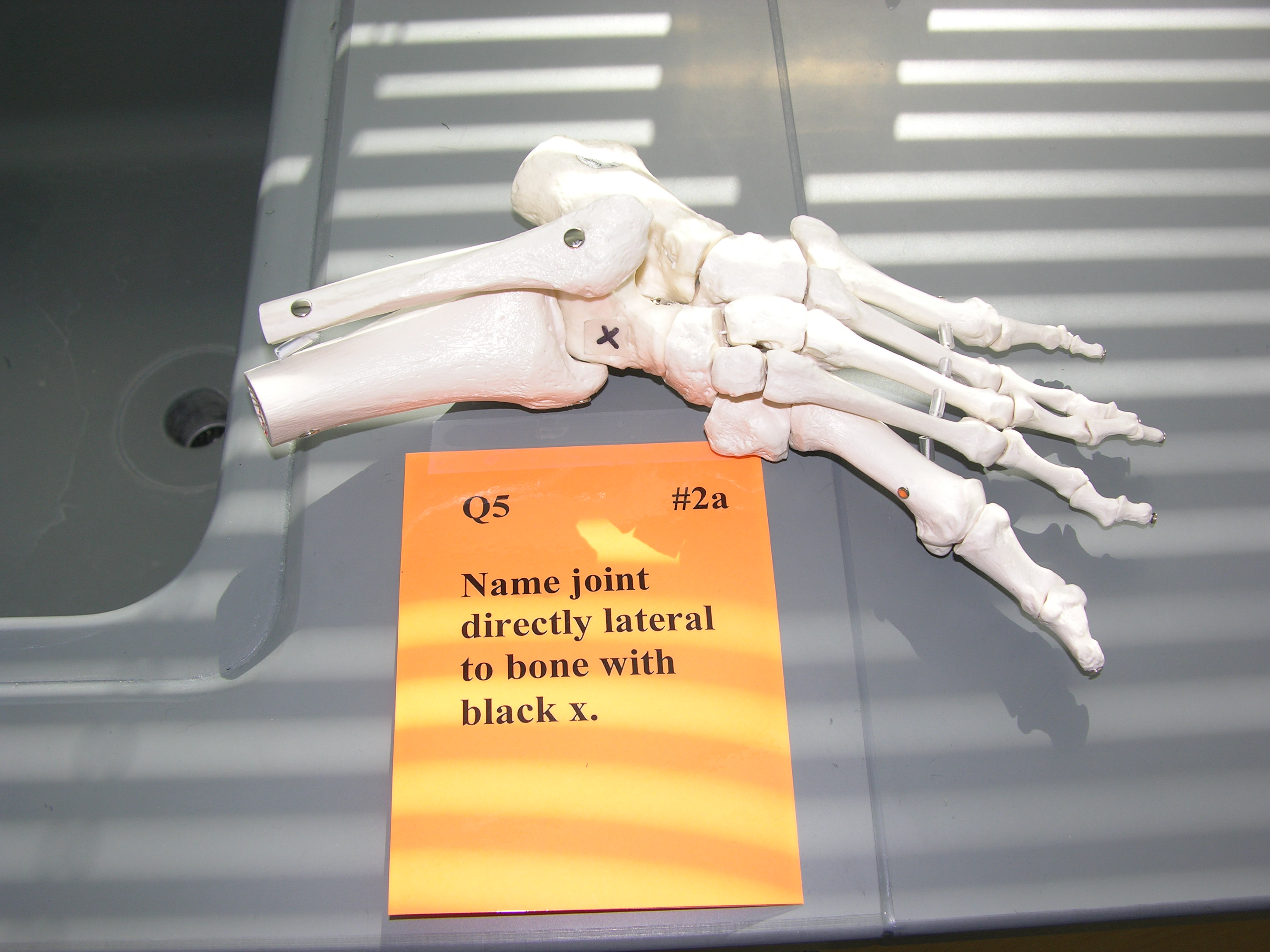 <p><span style="font-family: Lato Extended, Lato, Helvetica Neue, Helvetica, Arial, sans-serif; color: rgb(45, 59, 69)">Name the joint directly lateral to black x.</span></p>