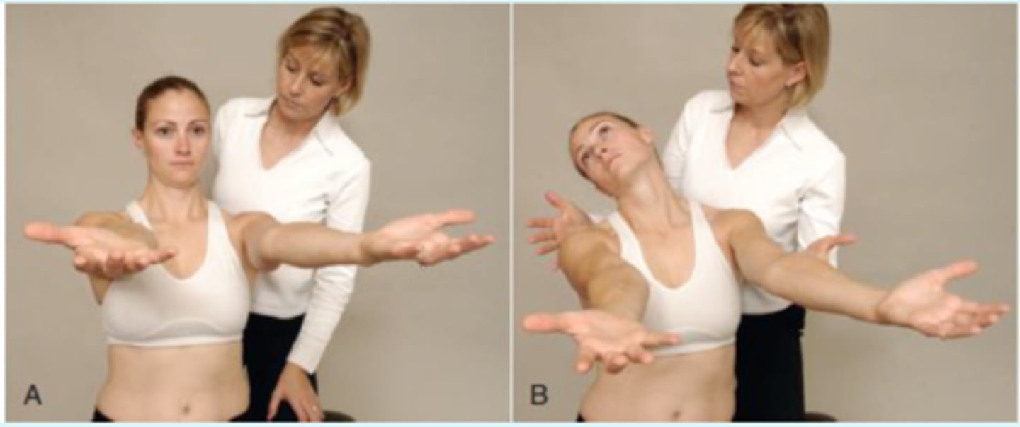 <p>- pt sitting with shoulders flexed to 90 and forearm supinated</p><p>- pt extends and rotates head/neck and closes eyes 10-30 seconds</p><p>- (+) = loss of UE position, onset of sxs (5DA3N)</p>