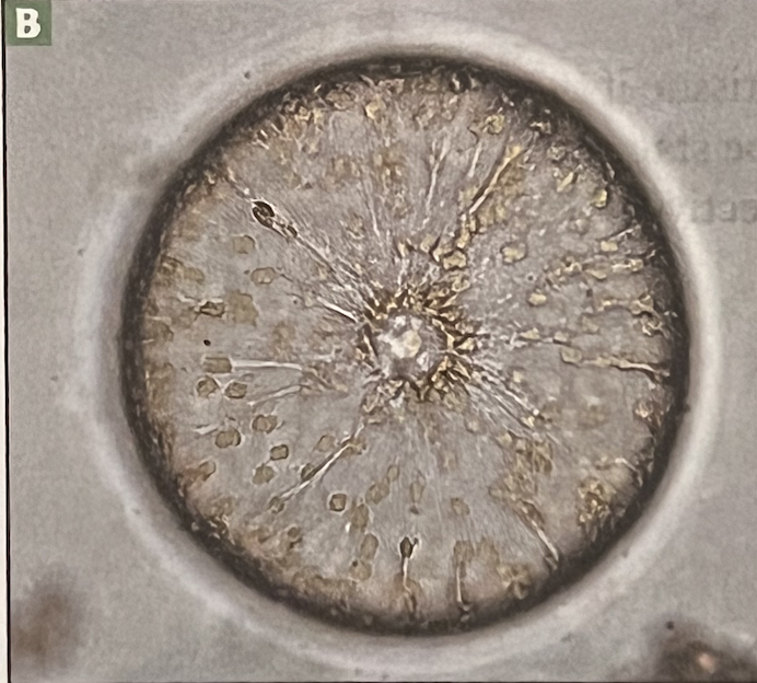 Diatom 