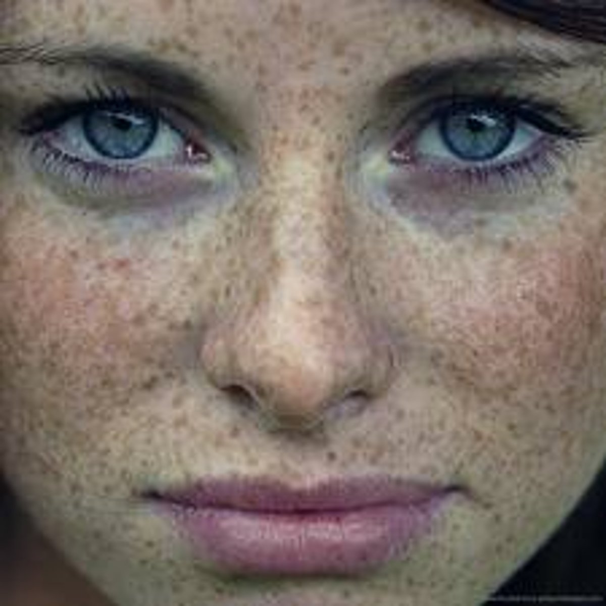 <p>freckles</p>