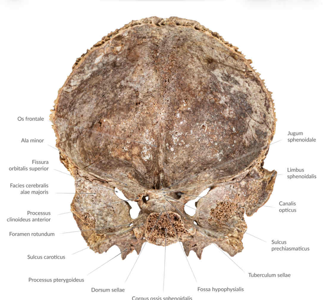 <p>tubercullum sellae</p>