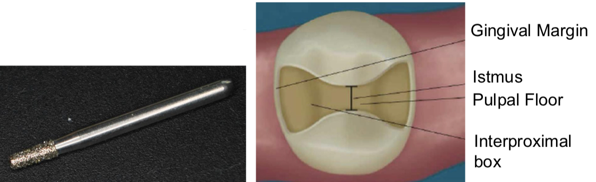 <p>Tapered flat-head diamond with rounded tip </p><p><strong>Outline &amp; Extension-</strong></p><p>Start from occlusal groove</p><p>Extend into proximal/free surfaces to form proximal box</p><p>Remove contact with adjacent tooth.</p><p><strong>Dimensions</strong>- </p><p>Occlusal depth- 1.5 mm (perpendicular to insertion path)</p><p>Isthmus width- 1.5–2 mm</p><p>Proximal axial depth- 1 mm</p><p>BL width: ~2 mm in larger boxes</p><p><strong>Divergent walls (10–15°) toward occlusal</strong></p>