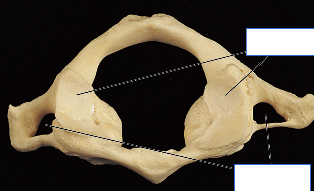 <p>Identify the features of the Atlas (C1)</p>