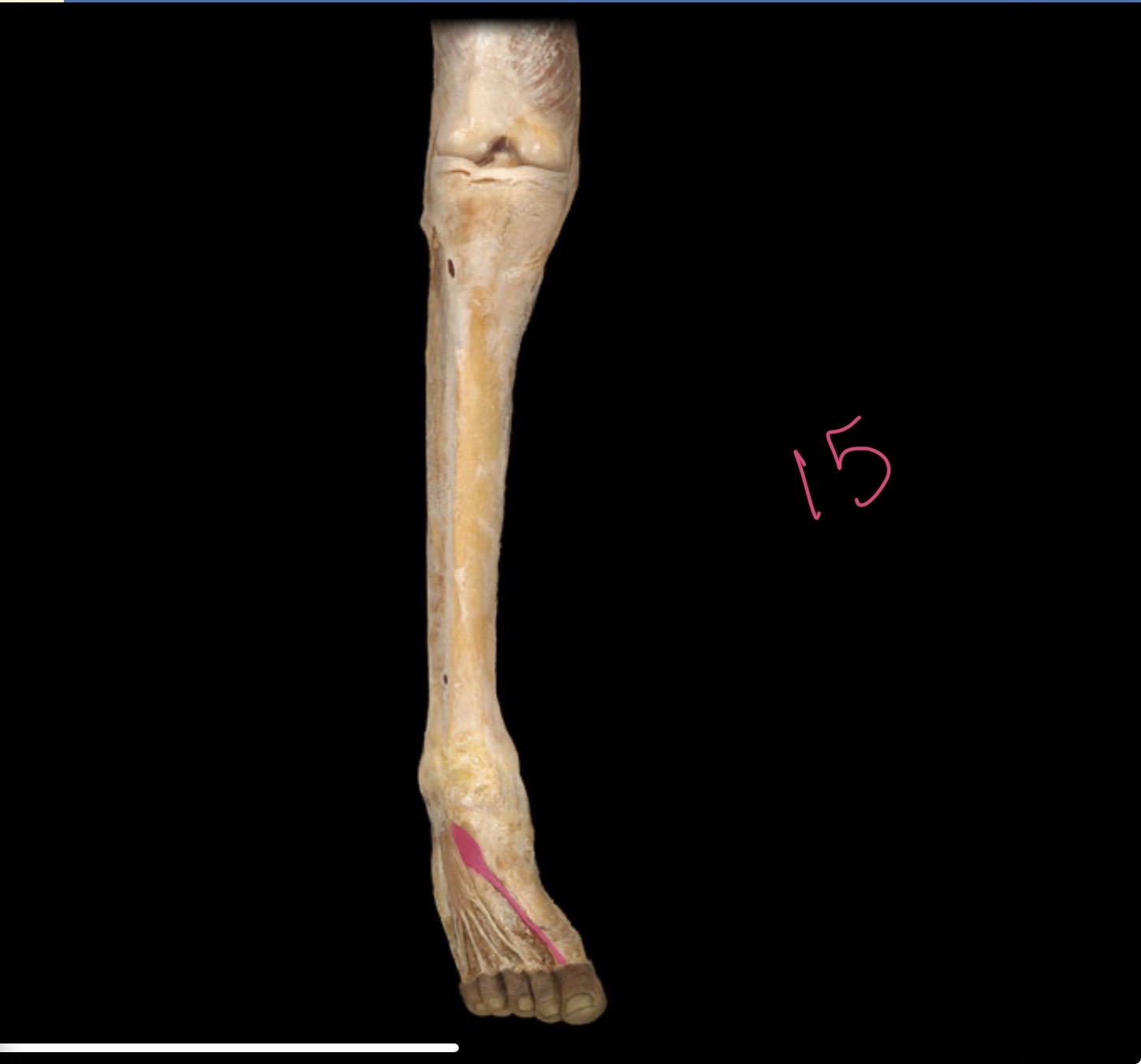 <p>Extensor hallucis m</p>