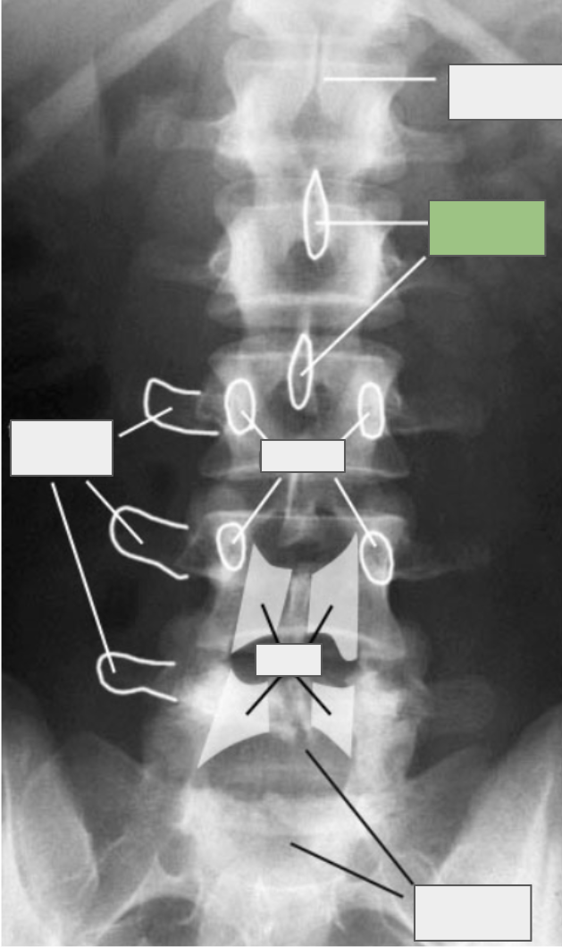 <p>What is referenced by the box highlighted in green?</p>