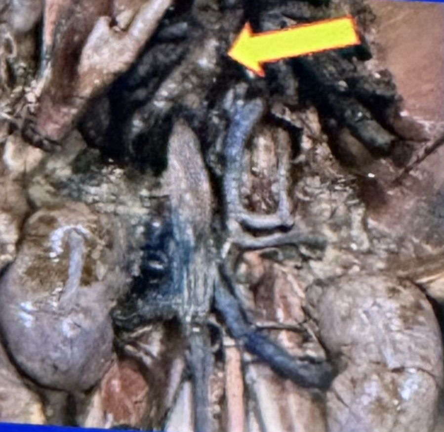 <p>Name the structure located cranial to the cubital joint and labeled by the big yellow arrow</p>