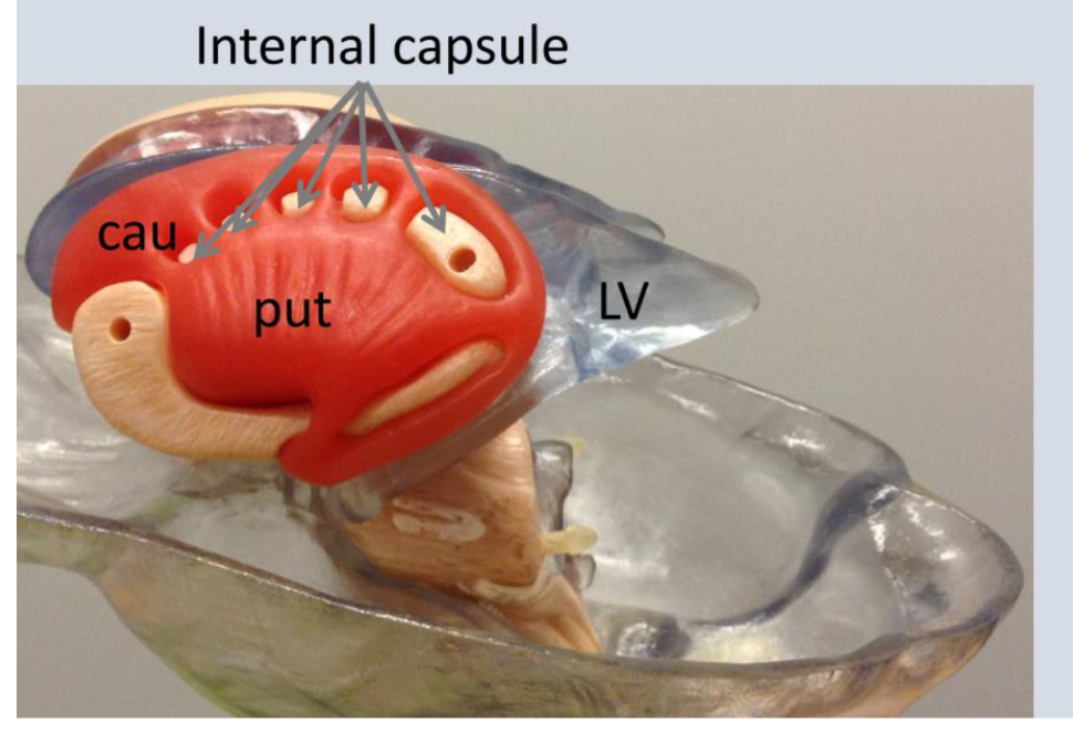 <p>Lateral ventricles</p>