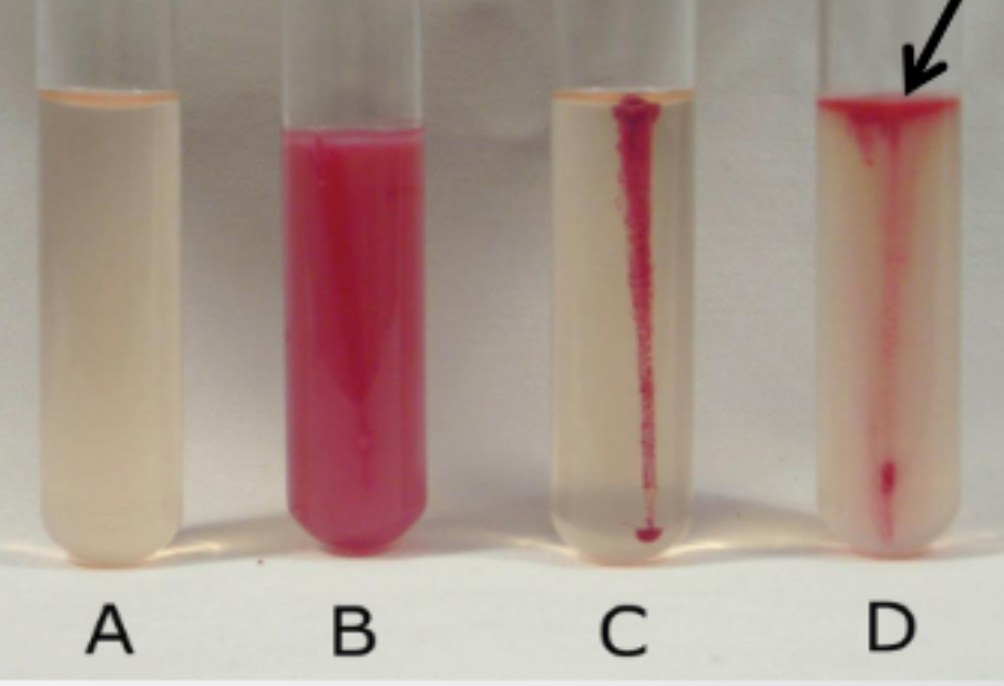 <p>Motility Test Results&nbsp;</p>